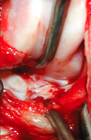 Formation CHIR2 : Chirurgie du grasset et de la hanche