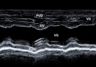 Formation EC001 : Echocardiographie : Modes BD et TM (Niveau 1)