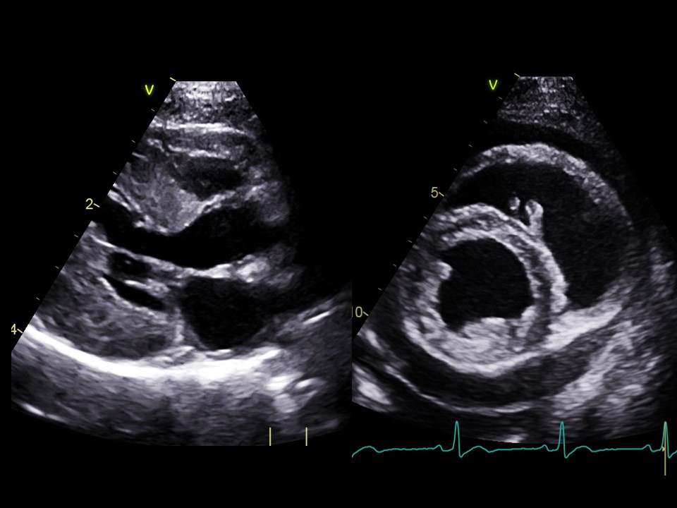Formation EC003 : Echocardiographie : Modes BD et TM - Aspects lésionnels (cas cliniques)