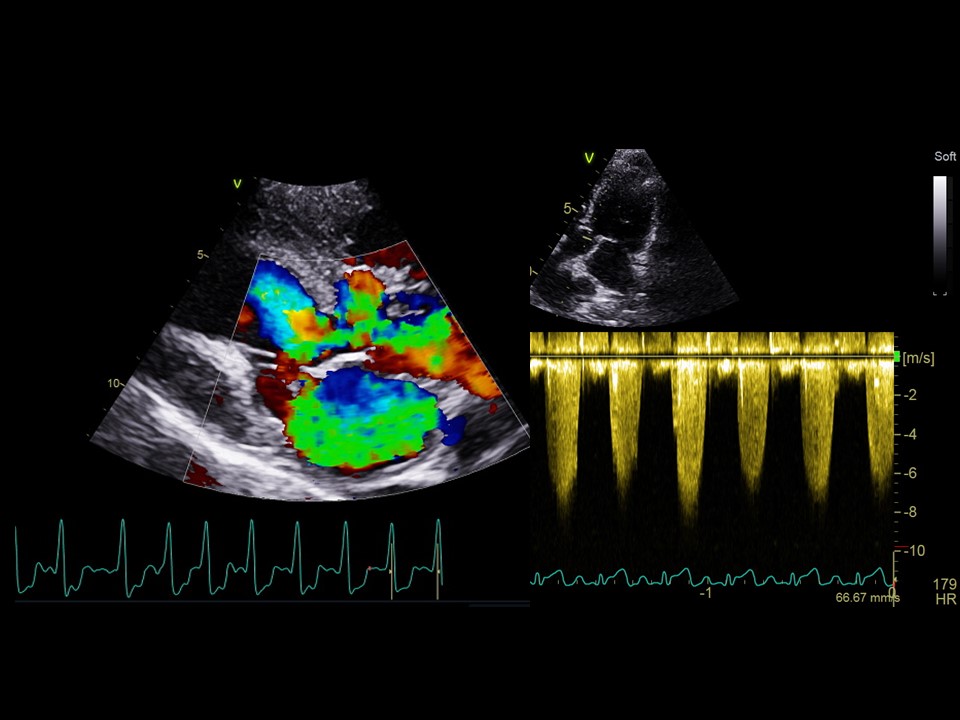 Formation EC004 : Echographie cardiaque, modes Doppler : aspects lésionnels (cas cliniques)